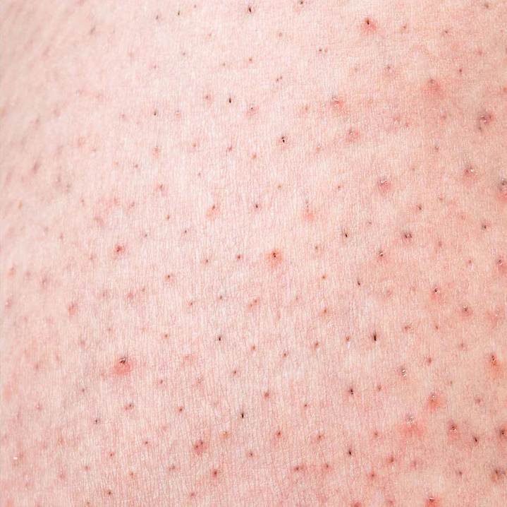 Steplya™ Tıraş Makinesi